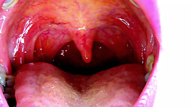 Sexy Scarlet Says Ahhhh - Uvula Showoff